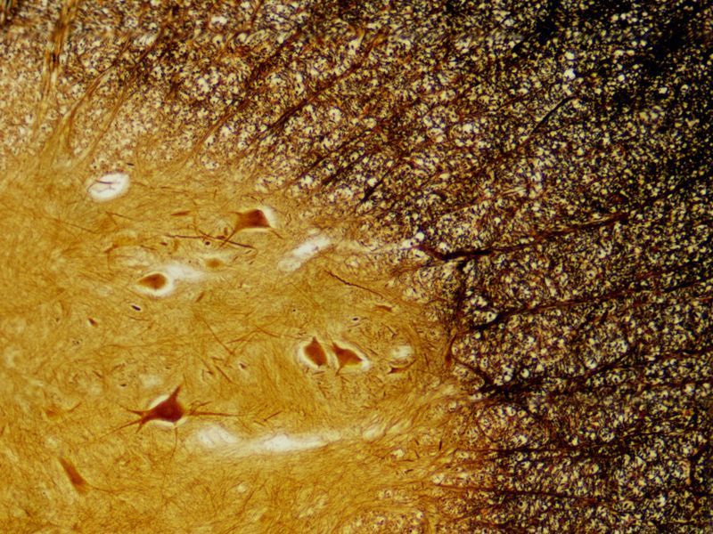 Набор препаратов Bresser 30 шт Histology 5985000 фото